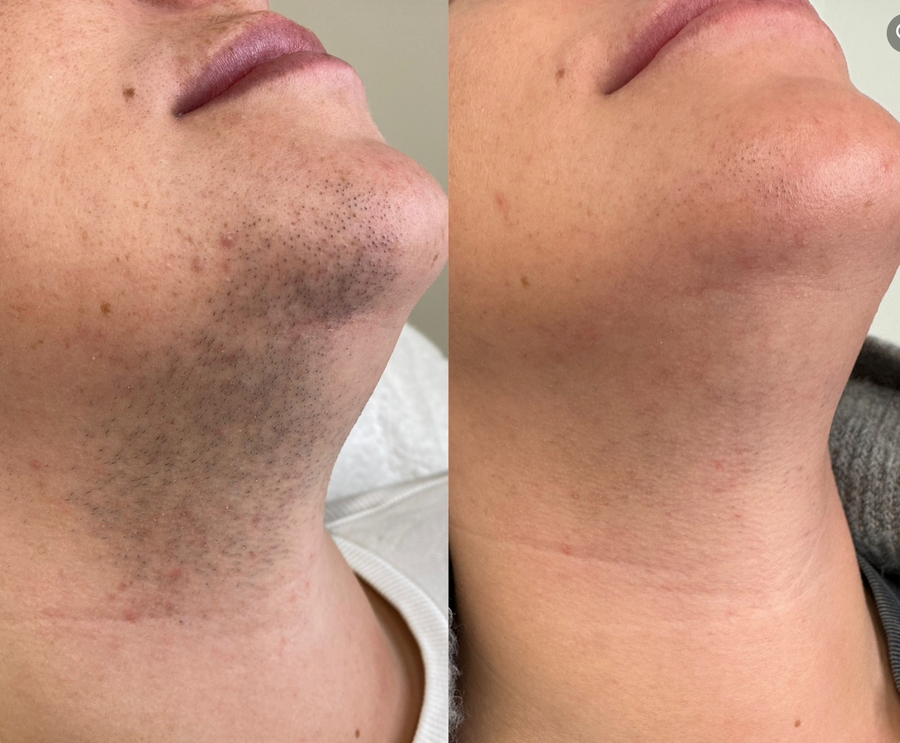 Smooth Skin In Just 5 Minutes